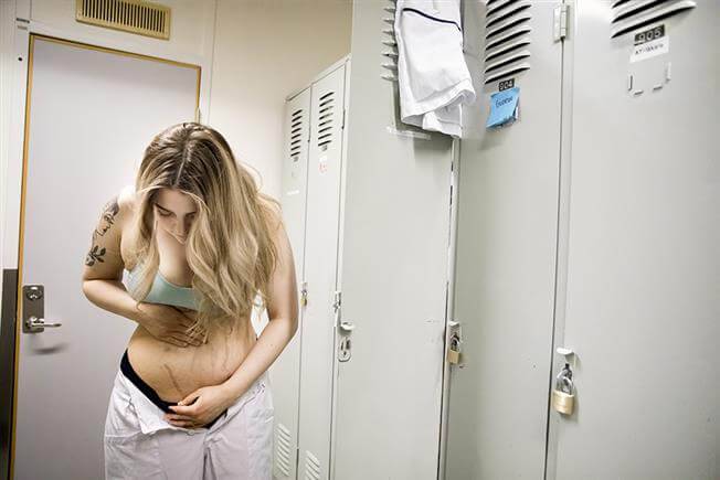 Sjuksköterskan linn fick njure av sin mamma